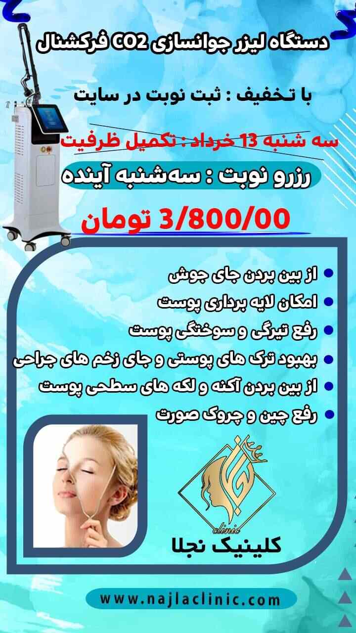 تخفیف لیزر CO2 فرکشنال